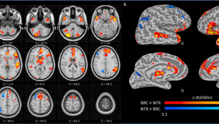 Cyberbullying Leaves Lasting Imprint on Teenage Girls’ Brains